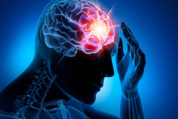0001_epilepsija-2021_1612781871-26f5939c8116b14df402cab8230e930f.jpg